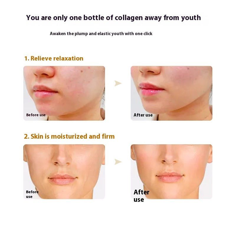 Collagen And Vitamin E Moisturizing And Moisturizing Care